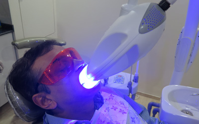 Philips Zoom for Teeth Whitening